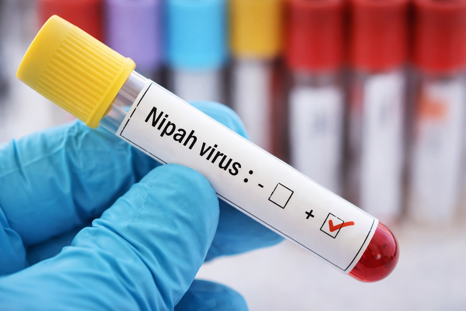 রাজ্যে ছড়াচ্ছে নিপা ভাইরাস, মৃত্যুঝুঁকি মারাত্মক; জেনে নিন কোন মাংস খাবেন না!