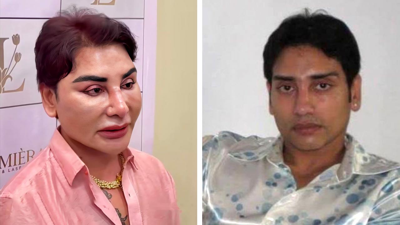 এস্থেটিক সার্জারির পর ফল পছন্দ না হলে কি আবার আগের রূপ ফিরে পাওয়া যায় কী বললেন নৃপেন্দ্র গুহ