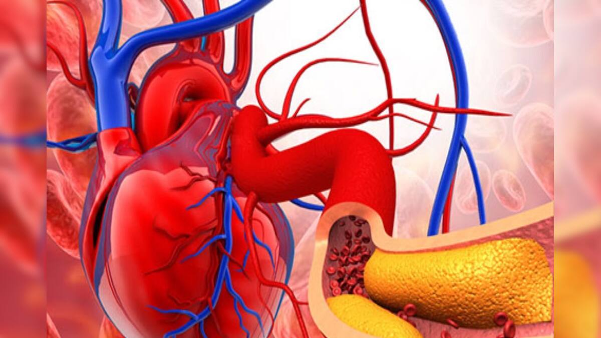 ৮০% ভারতীয়ের কোলেস্টেরল লেভেল অস্বাভাবিক, এর প্রভাবে কি বাড়ছে হার্ট অ্যাটাকে মৃত্যুর সংখ্যা