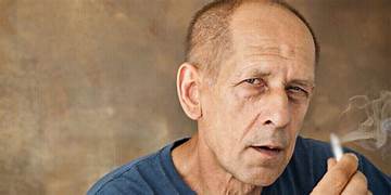 অতিরিক্ত ধূমপানে কি টাক পড়ে  চুল ঝরার সঙ্গে ধূমপানের গভীর সম্পর্ক ব্যাখ্যা করলেন বিজ্ঞানীরা